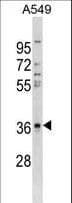 CTGF Antibody (aa166-193)
