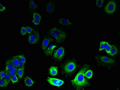 Polyclonal Rabbit anti-Human GPR21 Antibody (IHC)