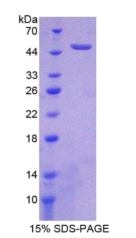 Rat FGFR1 / FGF Receptor 1 Protein (Recombinant His-T7)
