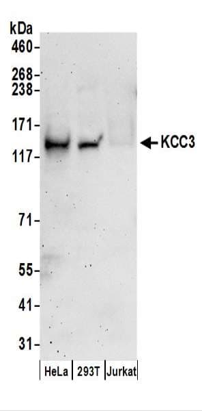 IHC-plus™ SLC12A6 / KCC3 Antibody (aa25-75)
