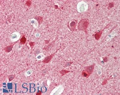 IHC-plus™ Polyclonal Rabbit anti-Human DPYSL2 / CRMP2 Antibody (aa461-510, IHC, WB)