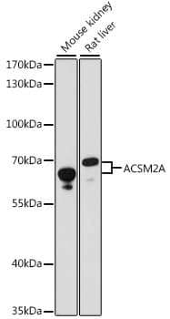 Polyclonal Rabbit anti-Human ACSM2A / MACS2 Antibody (WB)
