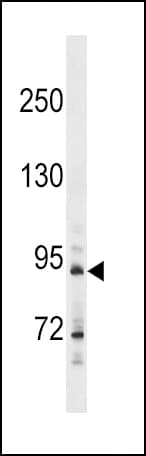 Polyclonal Rabbit anti-Human HHIP / HIP Antibody (aa25-54, WB)