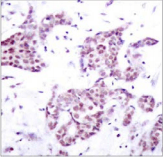 STAT6 Antibody