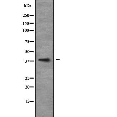 MATH2 / NEUROD6 Antibody