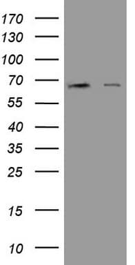 ER Alpha / Estrogen Receptor Antibody (aa1-310, clone OTI3G2)