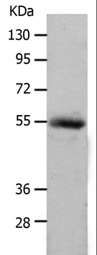 MMP17 Antibody