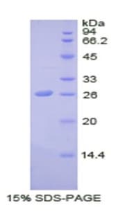 Human SDF4 Protein (Recombinant His)