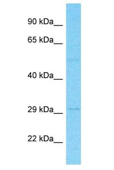 Polyclonal Rabbit anti-Human SLC22A15 / FLIPT1 Antibody (aa50-99, WB)