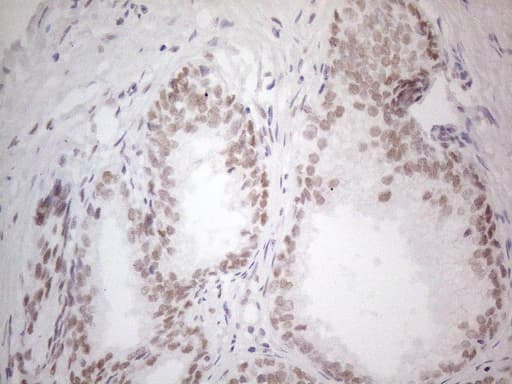 HDAC2 Antibody (aa415-488, clone OTI7E10)