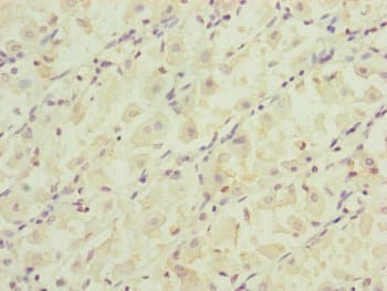 RARS2 / ARGRS Antibody