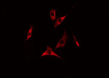 IOP1 / NARFL Antibody