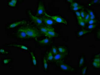 CCKAR / CCK1R Antibody