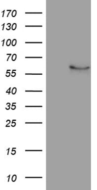 NFKBIE / IKB Epsilon Antibody (clone OTI1E5)