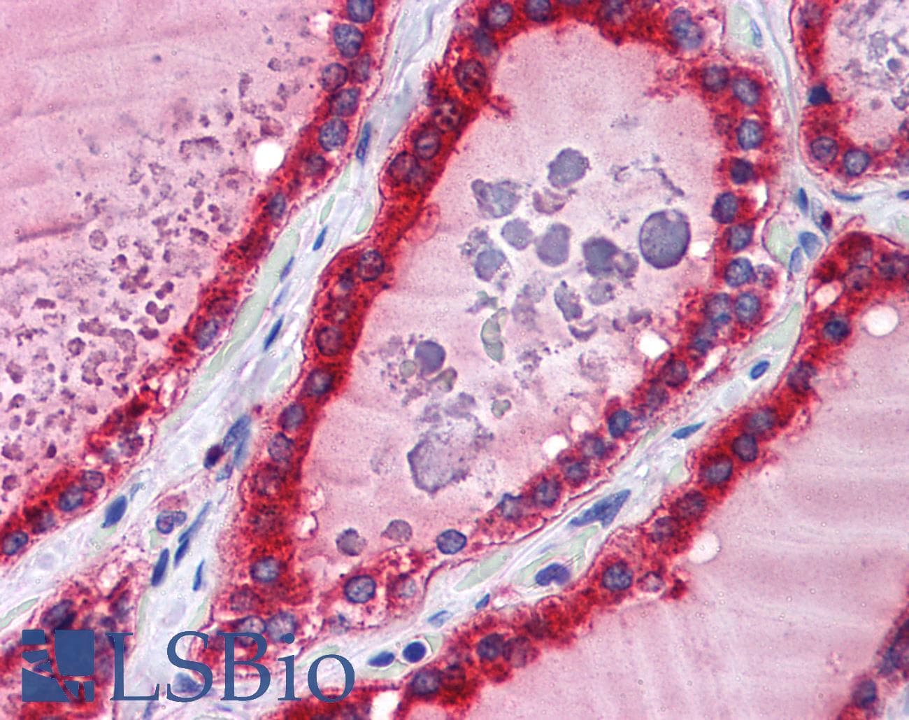 IHC-plus™ ADAM15 Antibody
