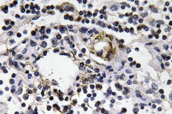 IFN Gamma / Interferon Gamma Antibody (Gln69)