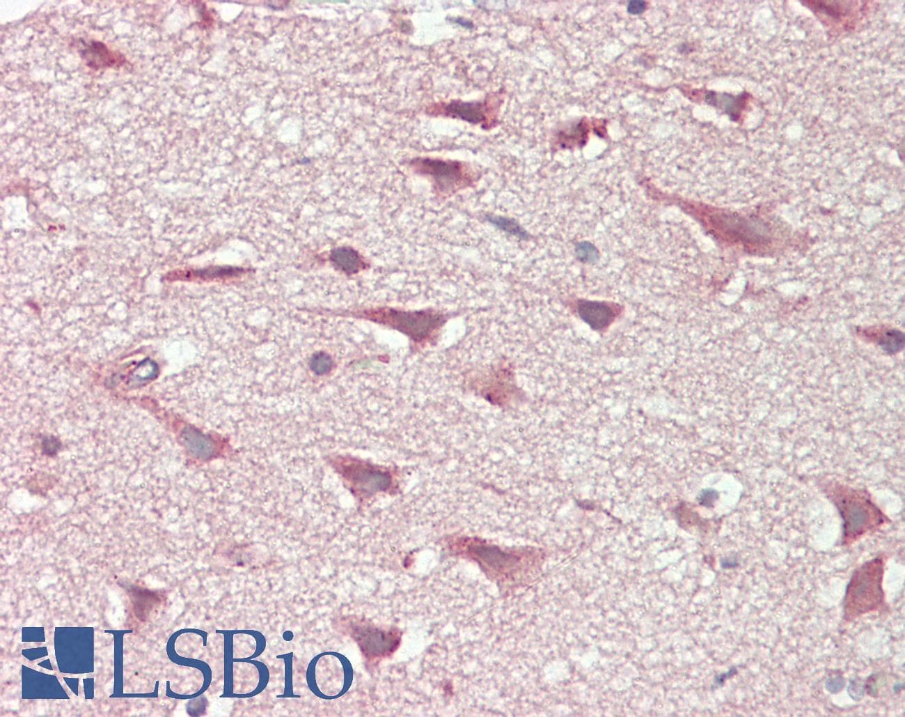IHC-plus™ SLCO6A1 / OATP-I Antibody (aa678-707)