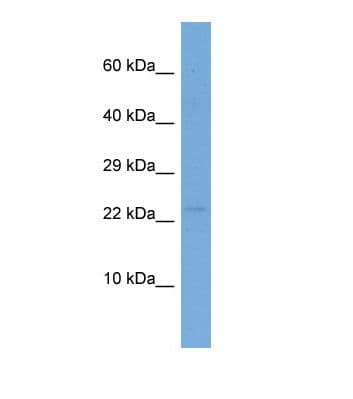 OBP2A Antibody (aa76-125)