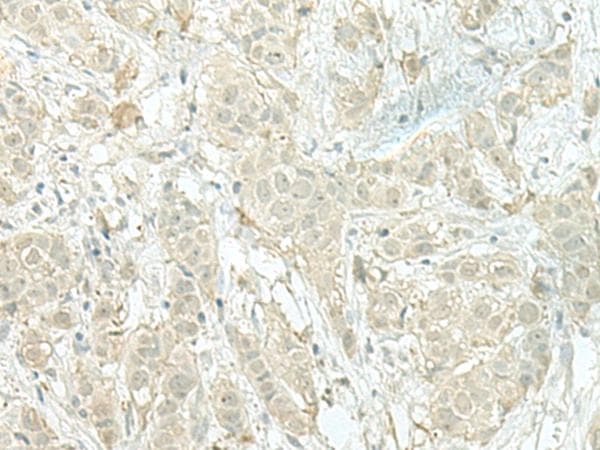 XTP4 / C17orf37 Antibody