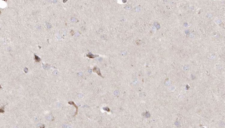 Polyclonal Rabbit anti-Human MLYCD / MCD Antibody (IHC, IF, WB)