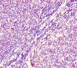 Polyclonal Rabbit anti-Rat HRAS / H-Ras Antibody (WB)