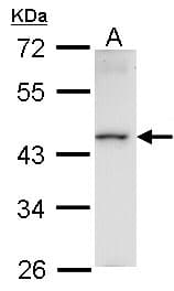 Polyclonal Rabbit anti-Human HMBOX1 Antibody (aa142-407, IHC, WB)
