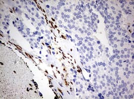 ZEB1 / AREB6 Antibody (aa1-350, clone OTI3G6)