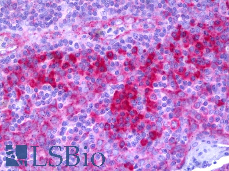 IHC-plus™ Polyclonal Rabbit anti-Human Complement C1R Antibody (aa445-494, IHC, WB)