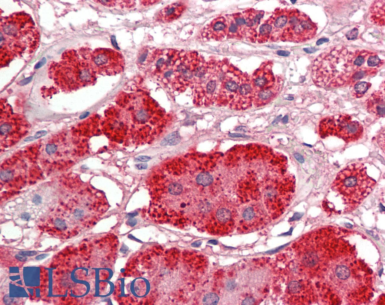 IHC-plus™ Polyclonal Goat anti-Mouse ACACB / ACC2 Antibody (aa217-231, IHC)