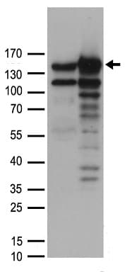 MYBBP1A Antibody