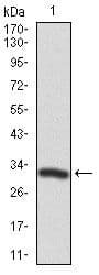 TWF1 / PTK9 Antibody (Amino Acid: 335-384, clone 7C11)