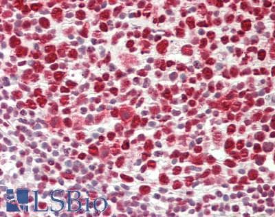IHC-plus™ PARP1 Antibody (clone 5F1)