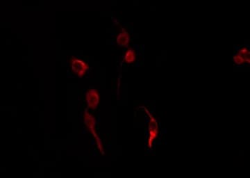 Polyclonal Rabbit anti-Human ZNF420 Antibody (IF, WB)