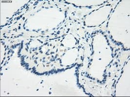 Monoclonal Mouse anti-Human GBP2 Antibody (clone OTI1E5, IHC, IF, WB)