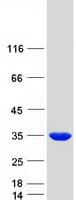 Human PMM2 Protein (Recombinant Myc-DDK (Flag))