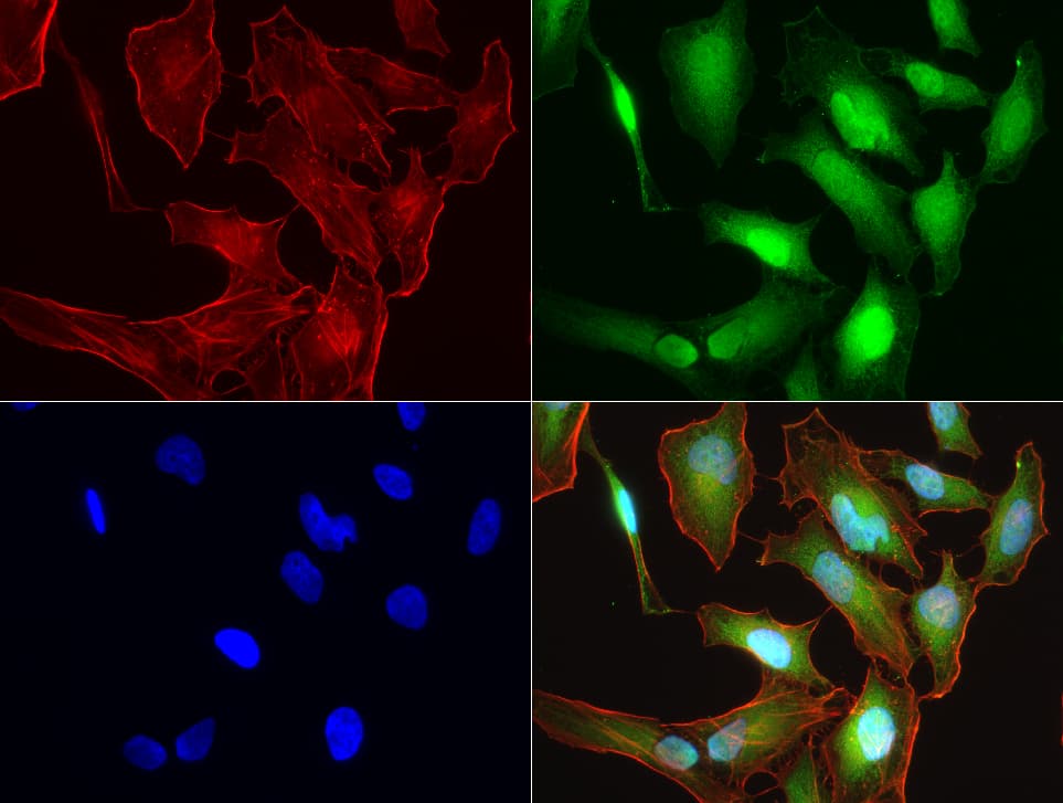S100A9 / MRP14 Antibody (clone UMAB173)