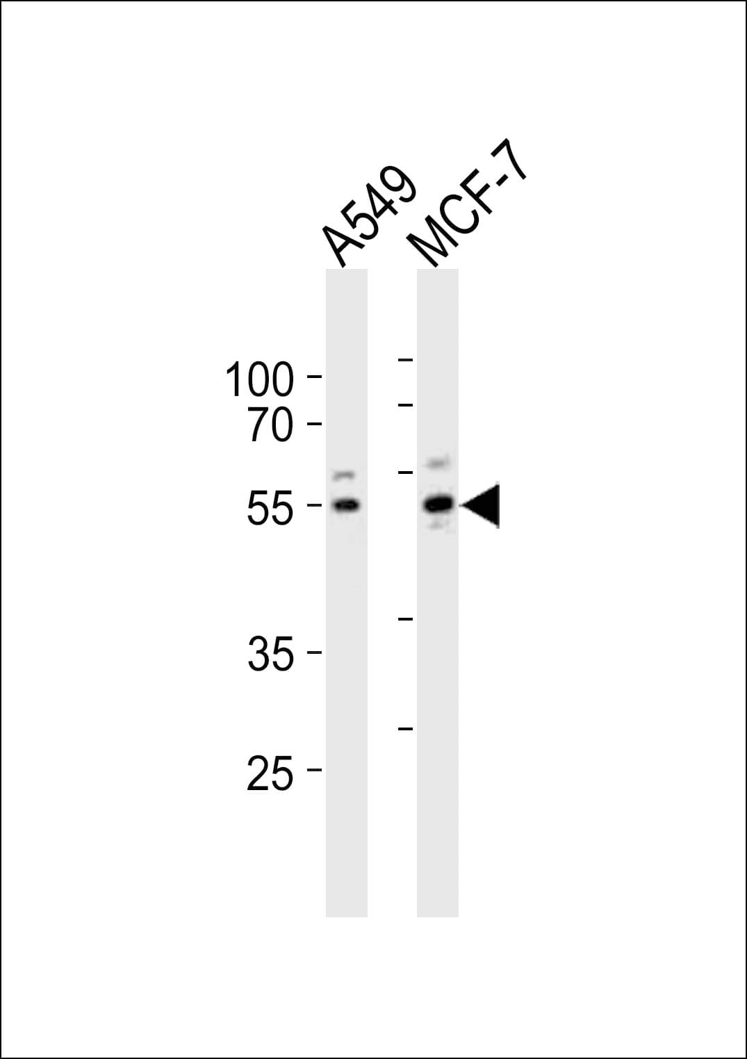 Polyclonal Rabbit anti-Human PPP2R2C Antibody (aa53-86, WB)