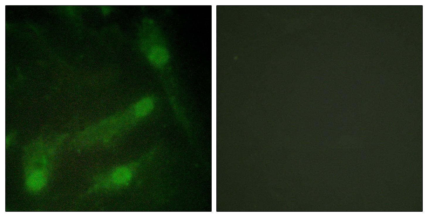 SMAD2 Antibody (phospho-Thr220)