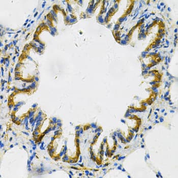AK1 / Adenylate Kinase 1 Antibody