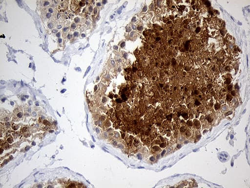 MSY2 / YBX2 Antibody (clone OTI3C12, Carrier-free)
