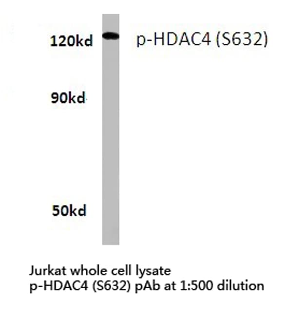 Polyclonal Rabbit anti-Human HDAC4 Antibody (phospho-Ser632, WB)