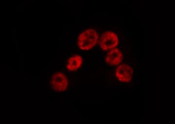 SP100 Antibody