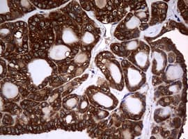 NME1 / NM23 Antibody (clone OTI7A1)