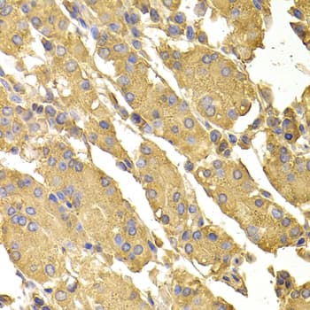 Polyclonal Rabbit anti-Human PP2Ac / PPP2CA Antibody (IHC, IF, WB)