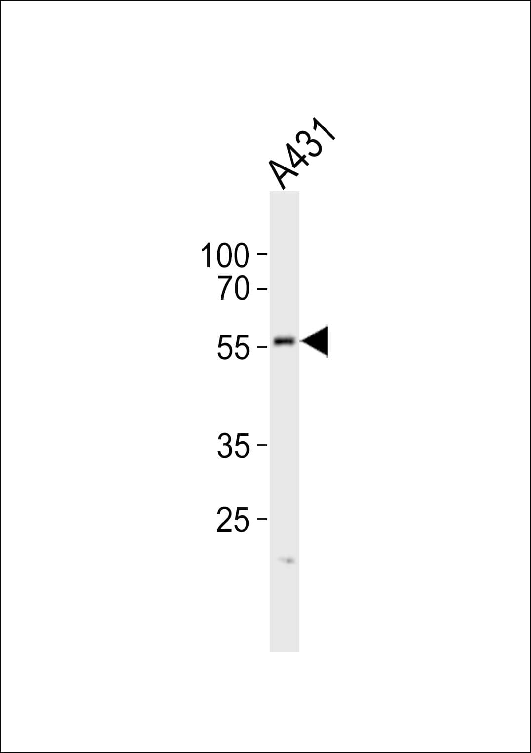 SPHK / SPHK1 Antibody (aa1-30)