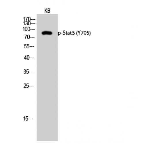 Polyclonal Rabbit anti-Human STAT3 Antibody (640-720 aa, IHC, WB)