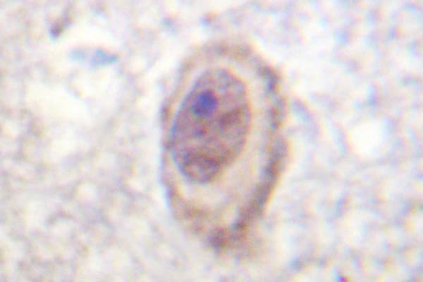 RAF1 / RAF Antibody (Gln39)