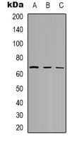 Polyclonal Rabbit anti-Human CAMKK2 Antibody (Internal, IHC, WB)