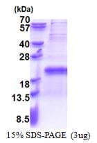 Human TXNRD3NB Protein (Recombinant His)