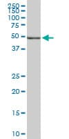 POLE2 Antibody (clone 1A3)